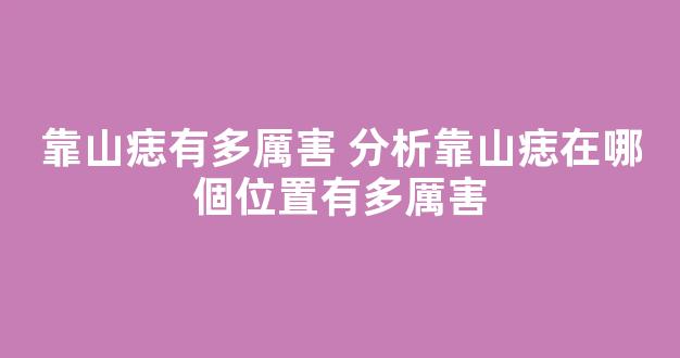 靠山痣有多厲害 分析靠山痣在哪個位置有多厲害